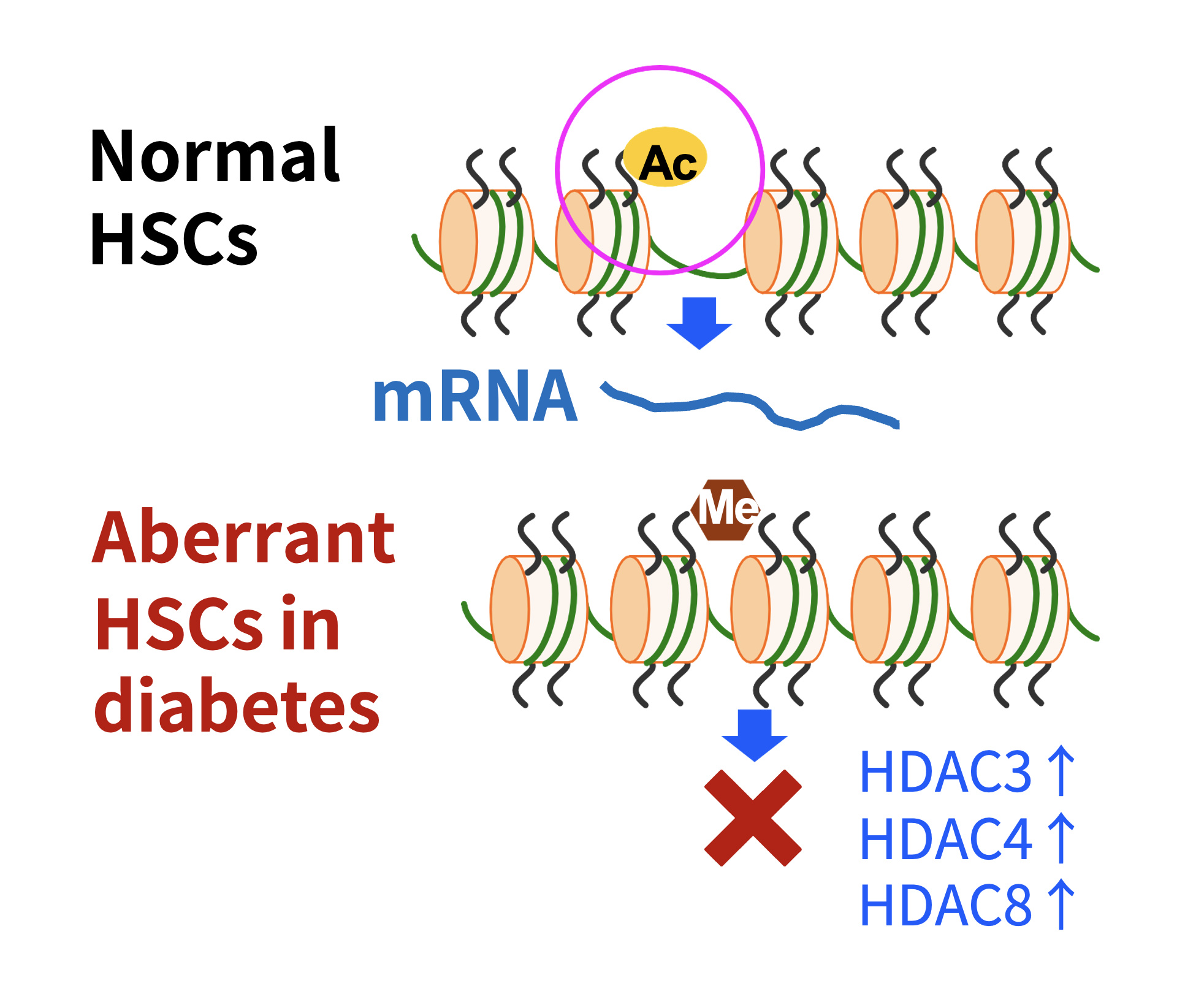 Abnormal High Expression of HDAC Observed in Diabetes Hematopoietic Stem Cells (Abnormal BMDCs)