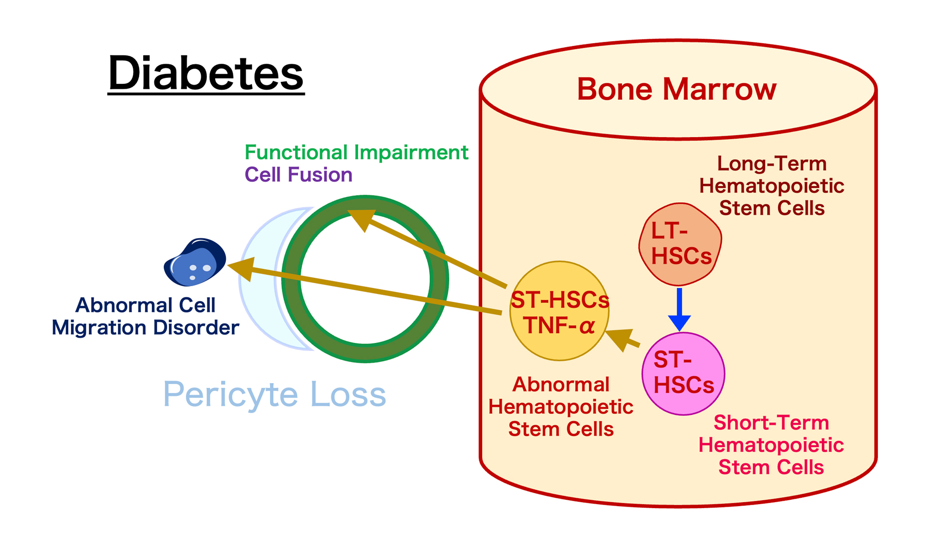 Abnormal Bone Marrow-Derived Cells (BMDCs) Cause Diabetes Complications